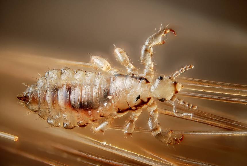 lice