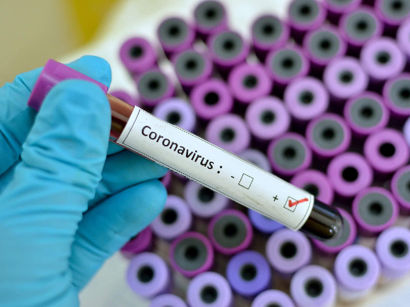 Coronavirus (Image Credit - Google)